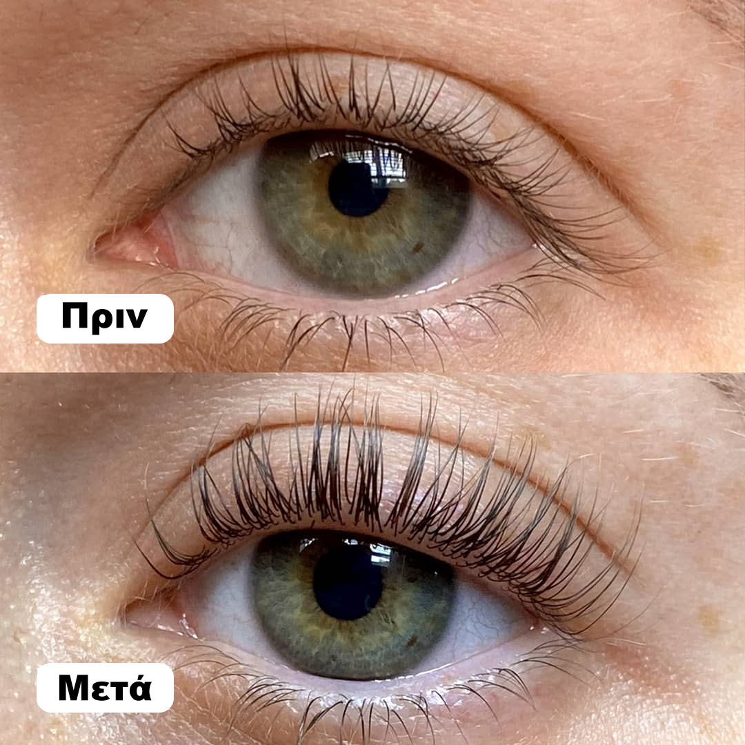 XEPA™ Ορός ανάπτυξης βλεφαρίδων